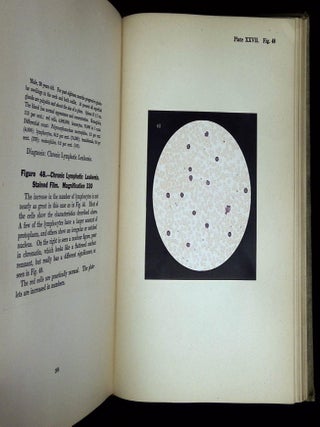 Hematological Atlas with a Description of the Technic of Blood Examination