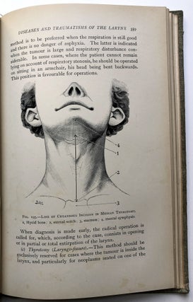 Elementary Practical Treatise on Diseases of the Pharynx and Larynx