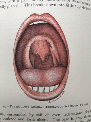 Elementary Practical Treatise on Diseases of the Pharynx and Larynx
