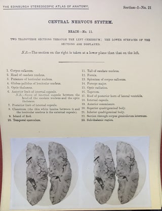 Stereoscopic Studies of Anatomy Prepared under the Authority of the University of Edinburgh: SECTION I (1): CRANIO-CEREBRAL TOPOGRAPHY / CENTRAL NERVOUS SYSTEM
