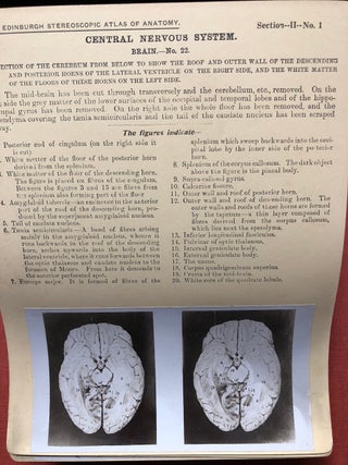 Stereoscopic Studies of Anatomy Prepared under the Authority of the University of Edinburgh: SECTION 2: Central Nervous System (Continued), Head and Neck