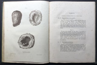 Graphic Illustrations of Abortion and the Diseases of Menstruation (1834)