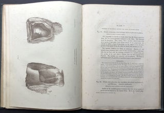 Graphic Illustrations of Abortion and the Diseases of Menstruation (1834)