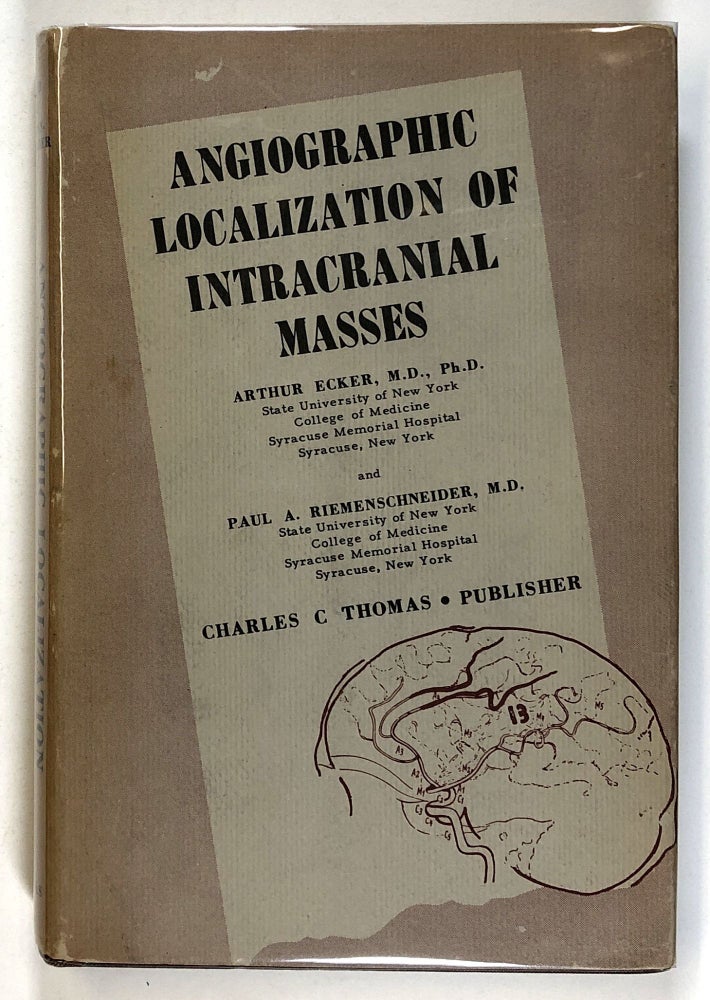 Item #s00026068 Angiographic Localization of Intracranial Masses. Arthur Ecker, Paul A. Riemenschneider.