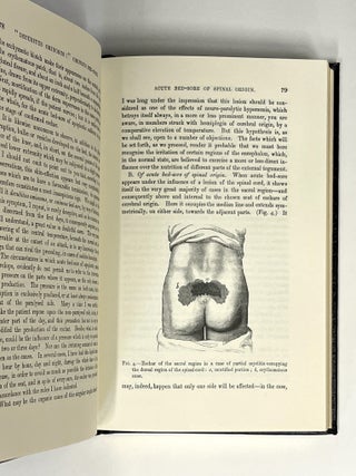 Lectures on the Diseases of the Nervous System -- Volumes I, II, III [Classics of Medicine facsimile edition, full leather gilt]