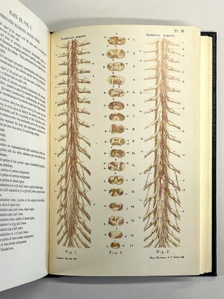 Lectures on the Diseases of the Nervous System -- Volumes I, II, III [Classics of Medicine facsimile edition, full leather gilt]